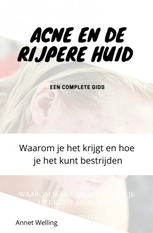 Acne bij volwassenen – Annet Wellen – boek cover