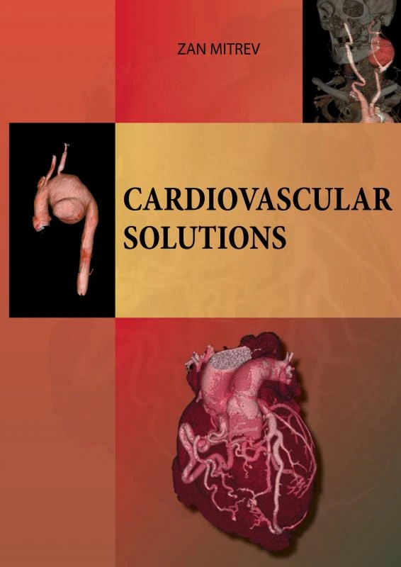 Cardiovascular Solutions – Zan Mitrev – boek cover